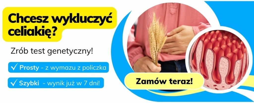 zamÓw teraz